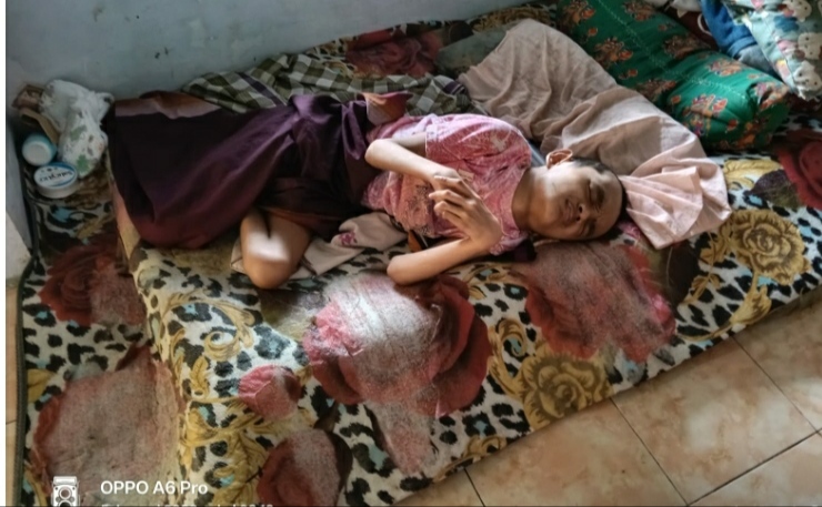 Dua Dekade Berjuang Melawan Kelumpuhan Wahyudi Pemuda asal Mlandingan – Situbondo Sangat Membutuhkan Uluran Tangan +++