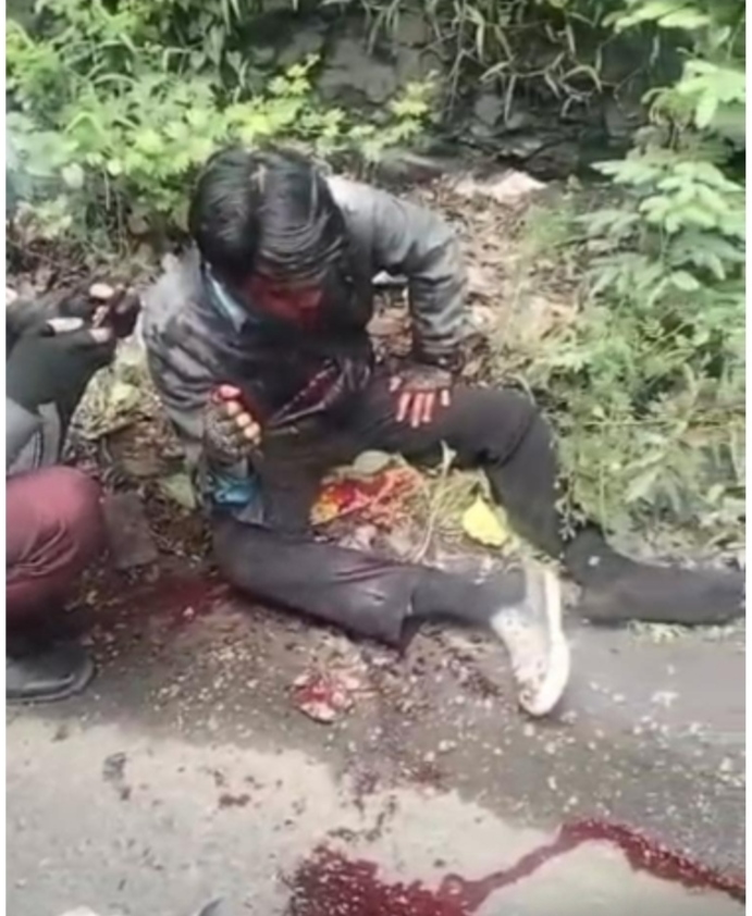 NYAWA TARUHANNYA …! Jalan Pantura Tamporah Memakan Korban, “Tambal Sulam Receh” jadi Sorotan +++